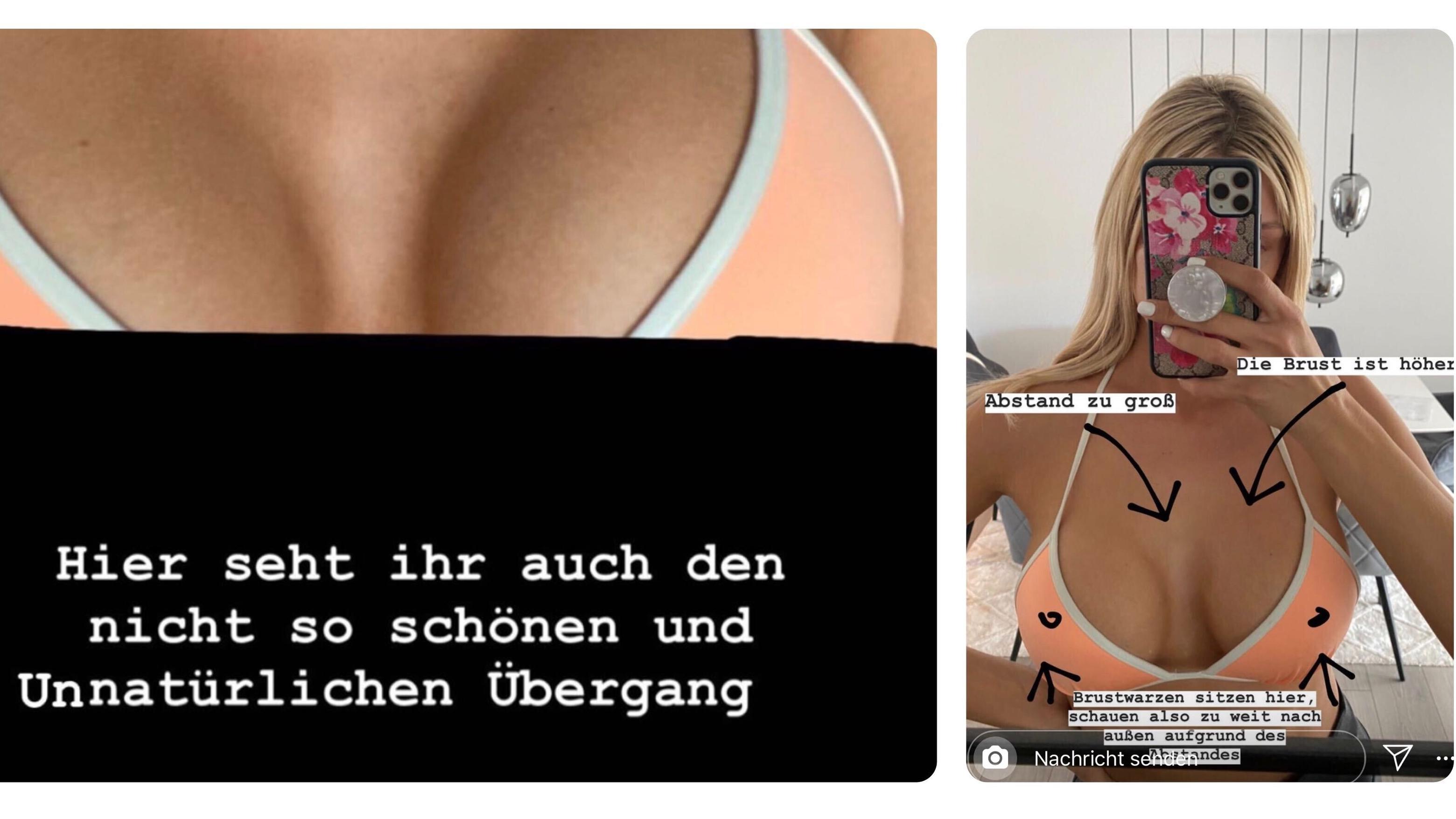 ex-bachelorette-gerda-lewis-darum-will-sie-neue-brueste